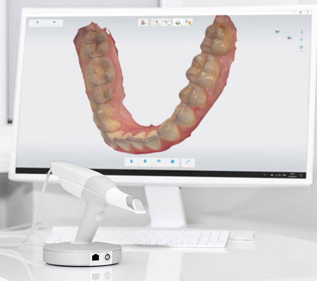 Los Angeles 3D Cone Beam and 3D Dental Scans