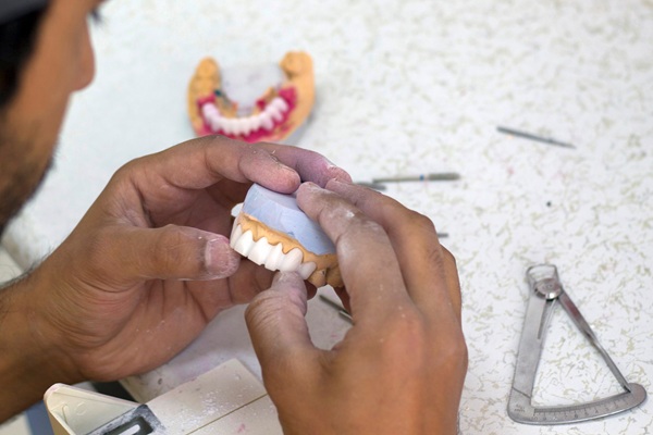 Rebuild Your Smile With Full Mouth Reconstruction