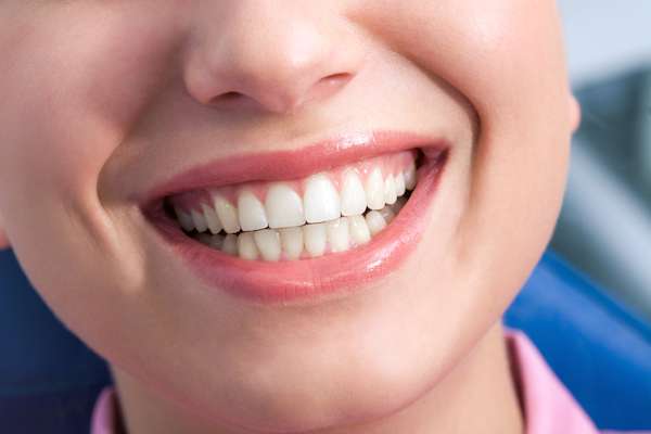 A General Dentist Discusses the Benefits of Tooth Straightening from Lida Davani, DDS in Los Angeles, CA