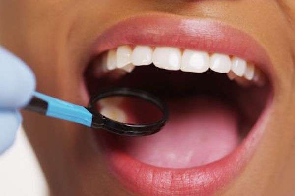 How a General Dentist Treats Cavities from Lida Davani, DDS in Los Angeles, CA