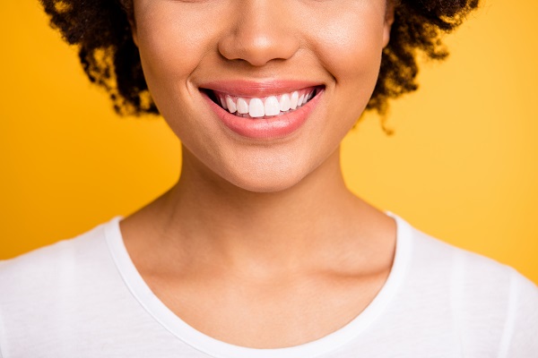 Choose Veneers To Correct Stained Teeth